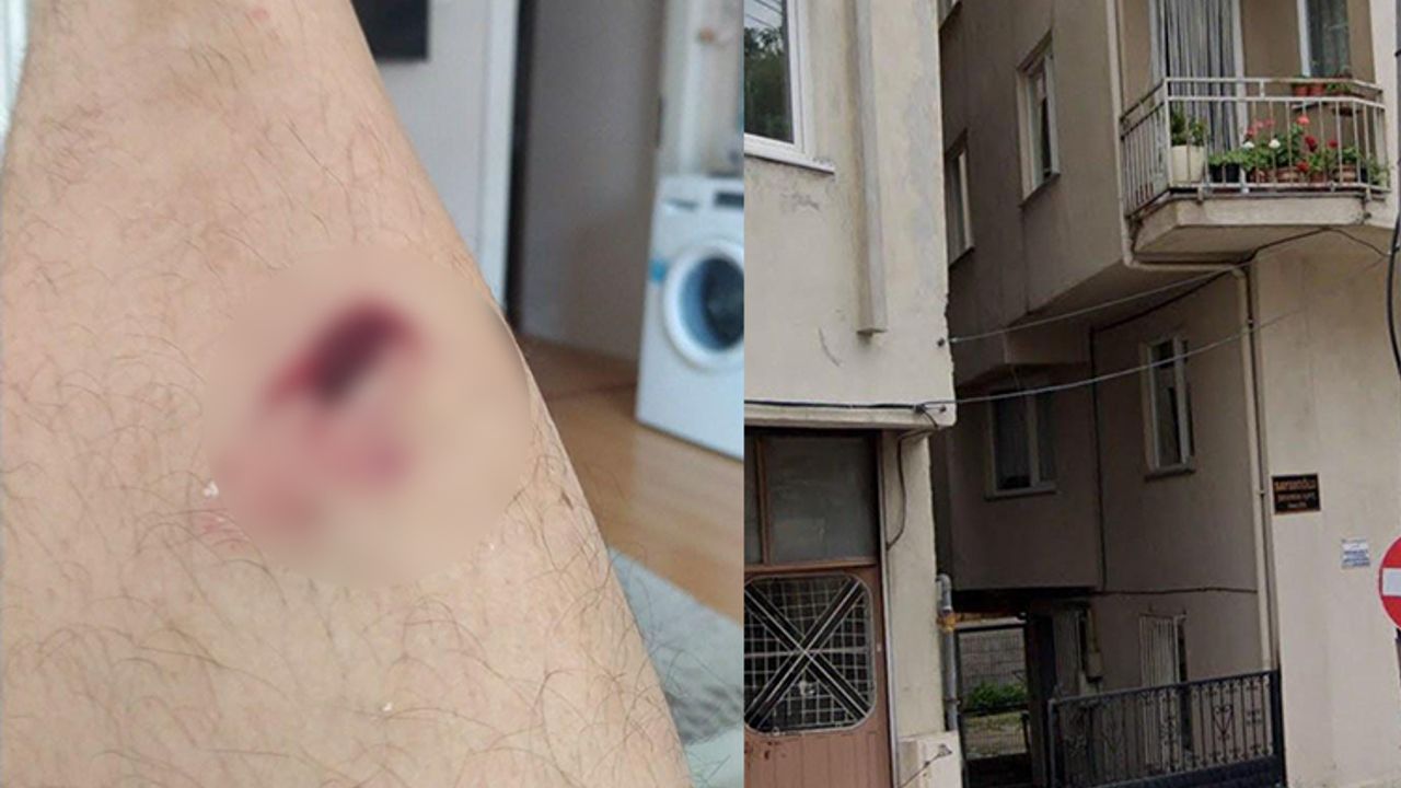 Bursa'da hırsızı yakalamak isterken ayağından yaralandı