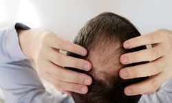 Kök hücre tedavisi ile saç dökülmesini durdurun
