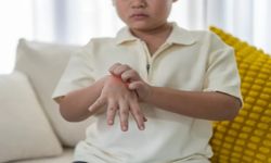 El-Ayak-Ağız Hastalığı Nedir?