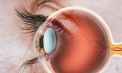 Retina ve Vitreus Hastalıklarına Dikkat