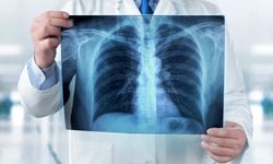 Akciğer kanserinde erken teşhisin önemi