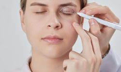 Blefaroplasti Nedir, Ameliyatı Nasıl Yapılır?