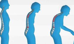 Sessiz tehlike: Osteoporoz