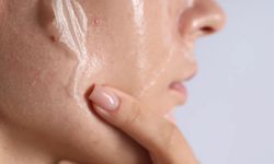 Ramazan'da Cilt Sağlığı Nasıl Korunur?