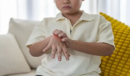 El-Ayak-Ağız Hastalığı Nedir?