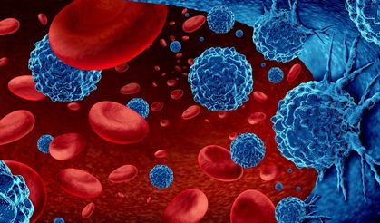 Kronik myeloid lösemi KML nedir?