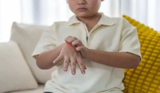 El-Ayak-Ağız Hastalığı Nedir?