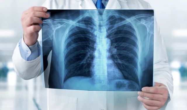 Akciğer kanserinde erken teşhisin önemi