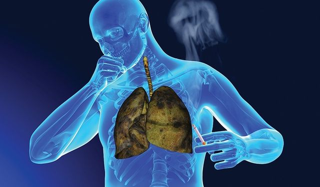 ''Akciğer kanseri kader değildir''