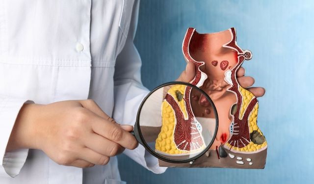 Hemoroid tedavisinde kişiye özel yaklaşım