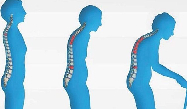 Sessiz tehlike: Osteoporoz