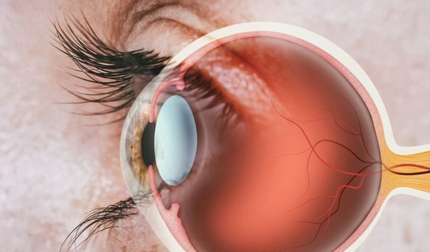 Retina ve Vitreus Hastalıklarına Dikkat