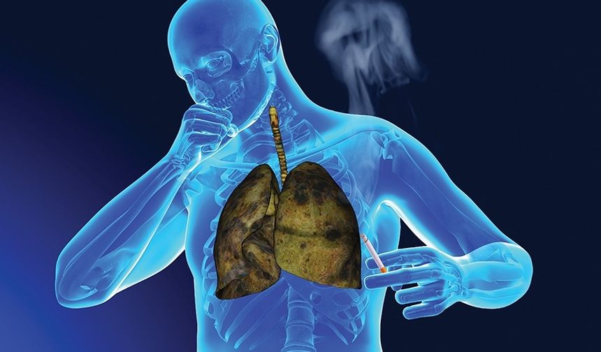 ''Akciğer kanseri kader değildir''