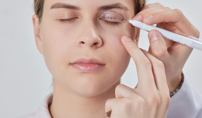 Blefaroplasti Nedir, Ameliyatı Nasıl Yapılır?